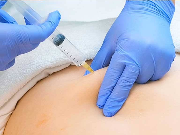 Patient suffering from lower back pain receiving Trigger Point Injections